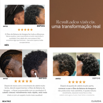 Moondoz Óleo Hoegoa™